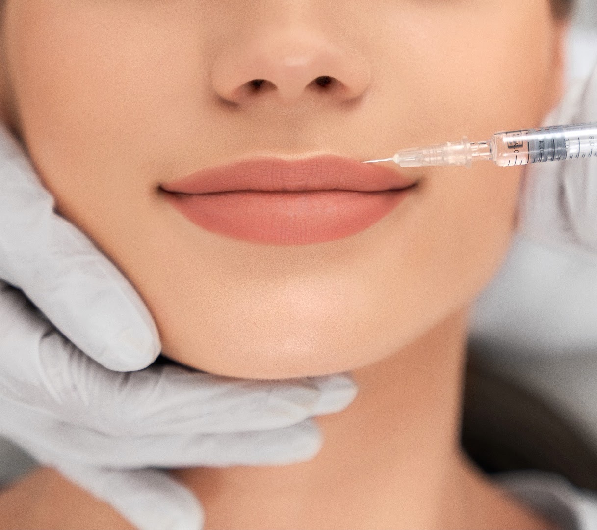 Dermal Fillers (In-England)